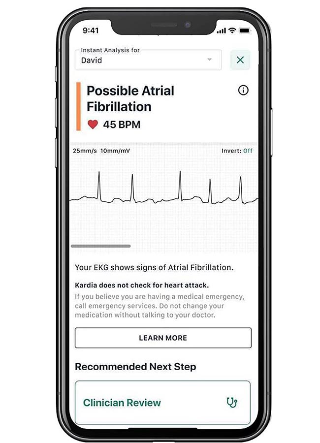 KardiaMobile 6L ECG